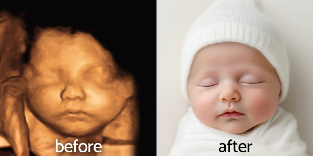 3D ultrasound imagery before and after